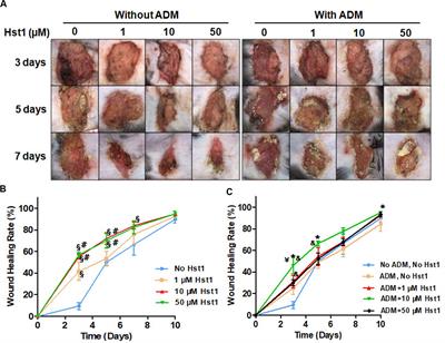 Human Salivary Histatin-1 Is More Efficacious in Promoting Acute Skin Wound Healing Than Acellular Dermal Matrix Paste